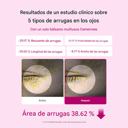 Bálsamo Anti-Arrugas Vueltix