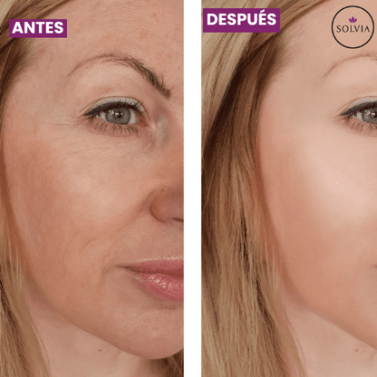 Bálsamo Anti-Arrugas Vueltix