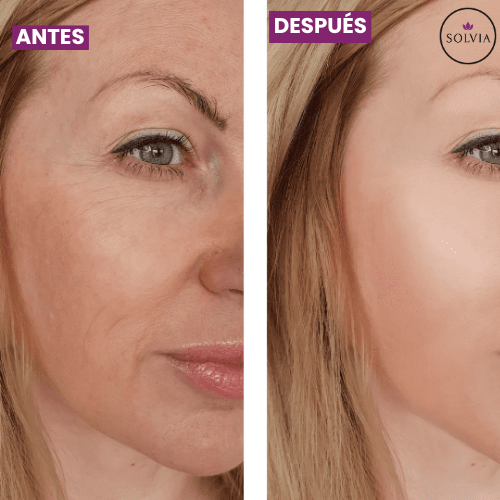 Bálsamo Anti-Arrugas Vueltix